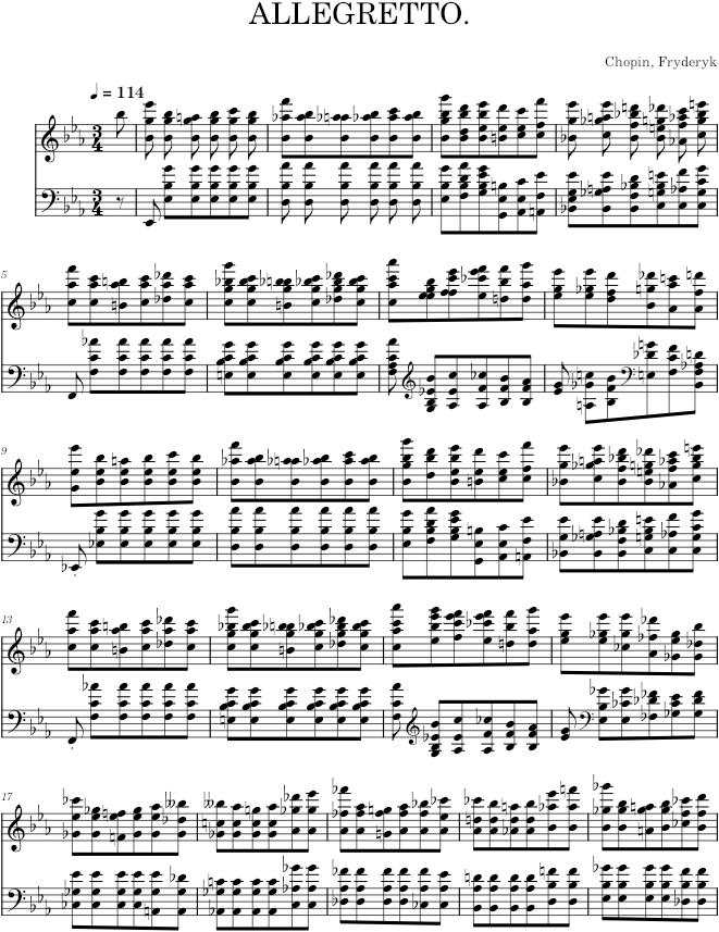 Etude in E-flat major Op. 10 No. 11 (Kistner ed.) - Chopin — first page preview