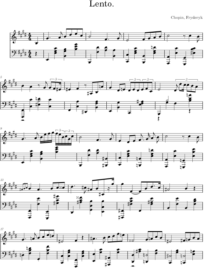 Nocturne in E major Op. 62 No. 2 (Brandus ed.) - Chopin — first page preview