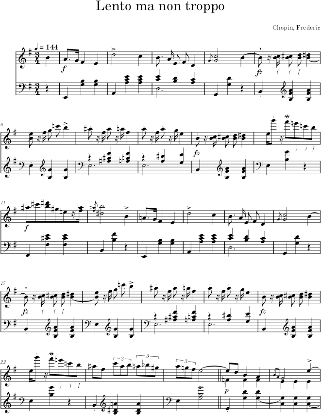Mazurka in E Minor, Op. 17, No. 2 - Chopin — first page preview